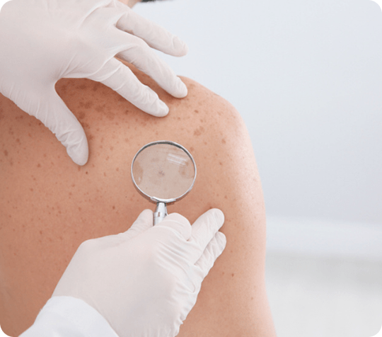 DermaScan App Preview